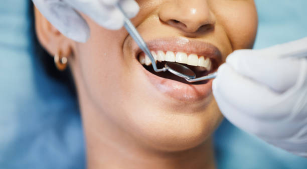 Best Emergency Root Canal Treatment in Scissors, TX