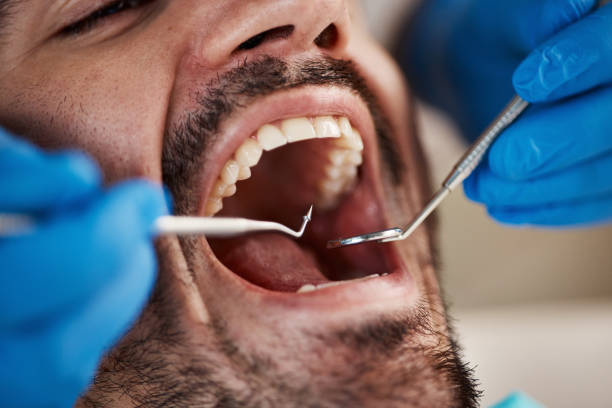 Best Cosmetic Emergency Dentistry in Scissors, TX